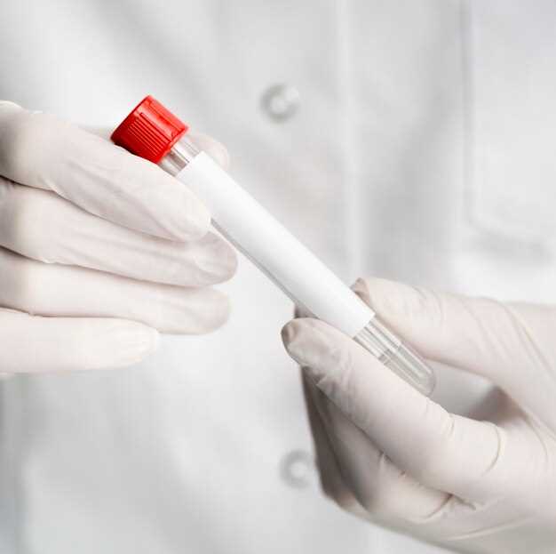 RW в крови: важность для диагностики инфекции