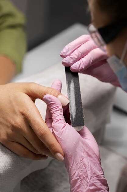 Грибок ногтей: опасность, причины, лечение и профилактика