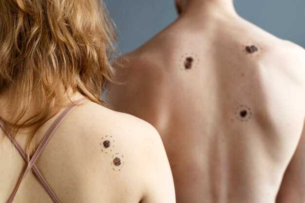 Симптомы и идентификация коричневых точек на теле