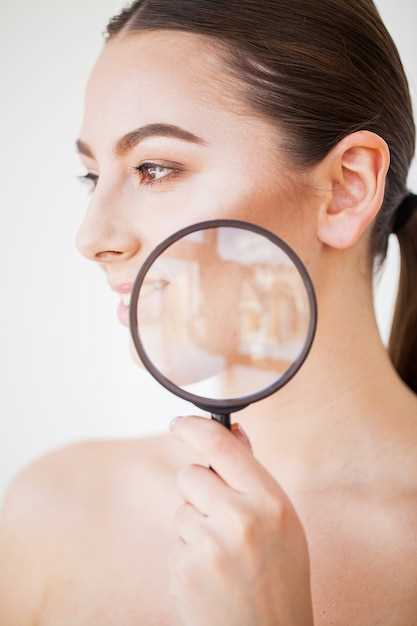 Дерматомикоз гладкой кожи: симптомы, лечение и фото