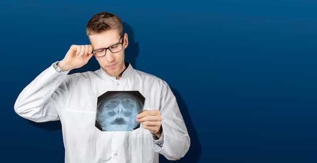 Диагностика гайморита на рентгенограмме