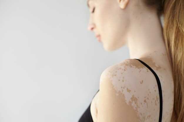 Методы устранения рубцов и шрамов на коже