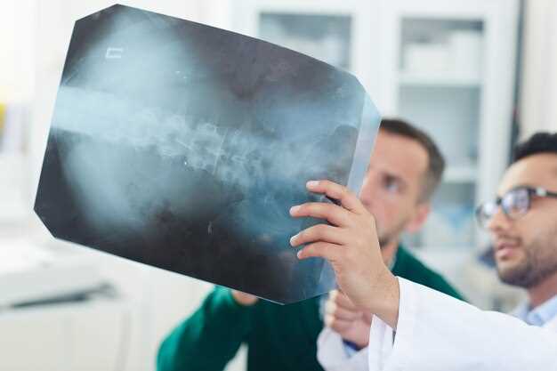 Оптимальный период между КТ и рентгеном: когда начинать?