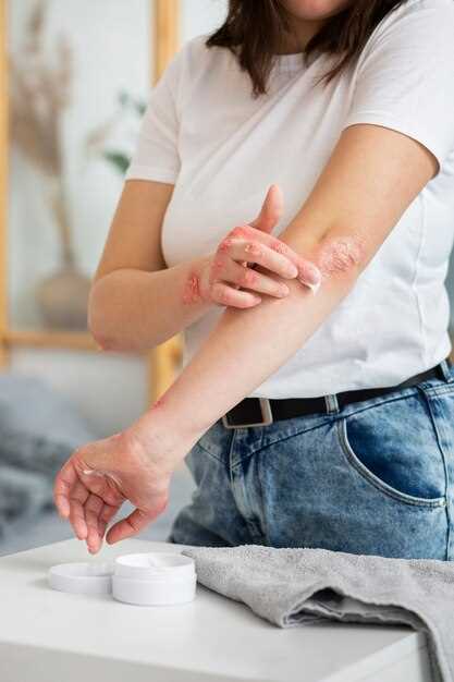 Лучший крем от аллергии на коже у взрослых: обзор и отзывы