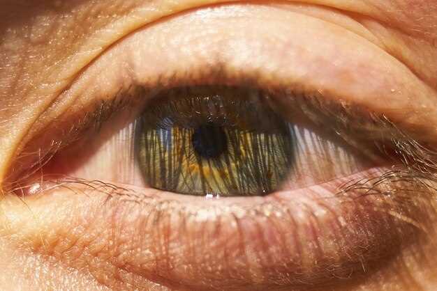 Причины желтых белков глаз