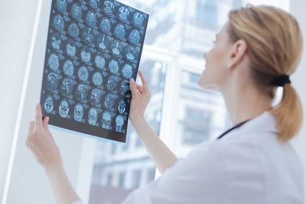 Рентген мозга: когда и зачем исследуют