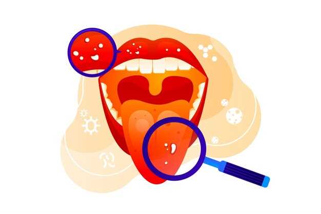 Язвочки на языке при ангине - симптомы и лечение